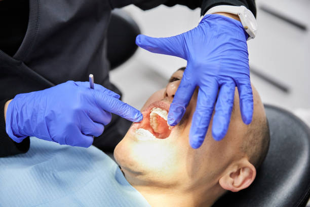 Best Chipped Tooth Repair Near Me  in Lantana, TX